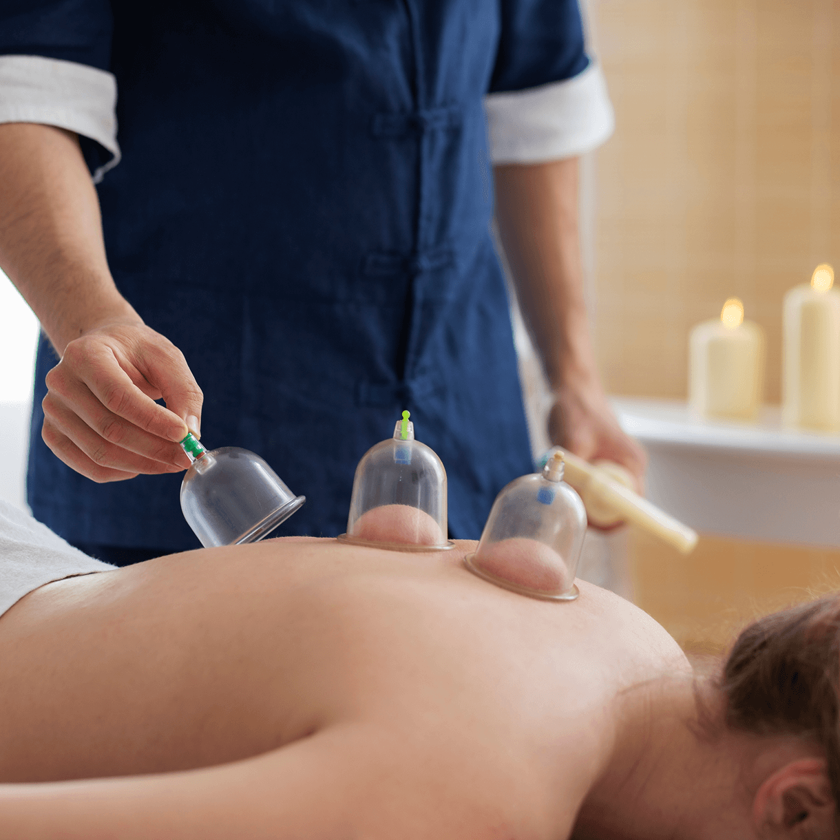 Cupping