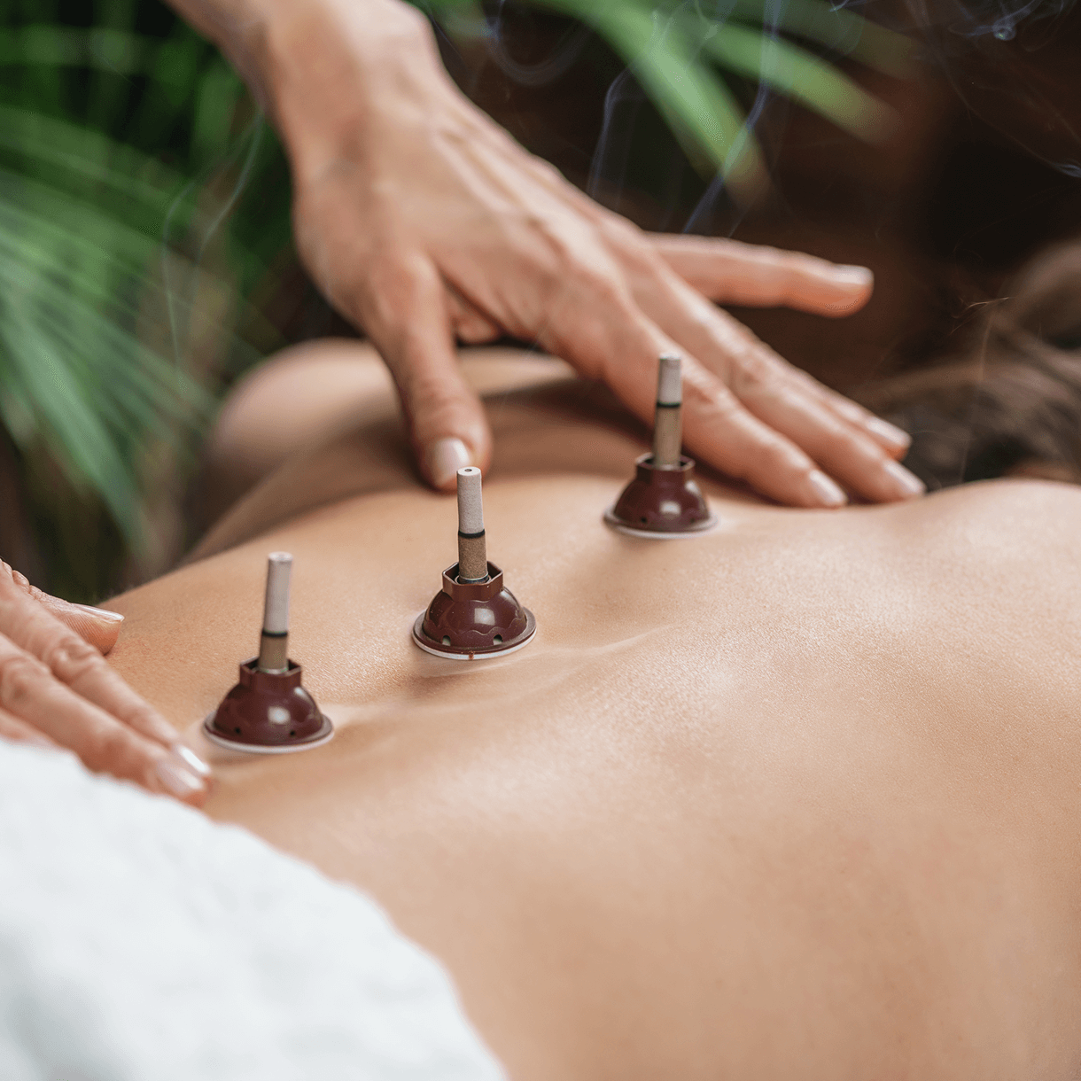 Moxibustion