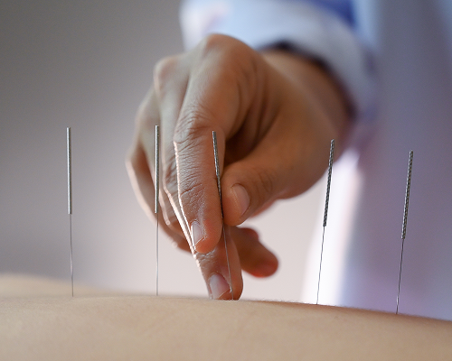 Follow-Up Acupuncture